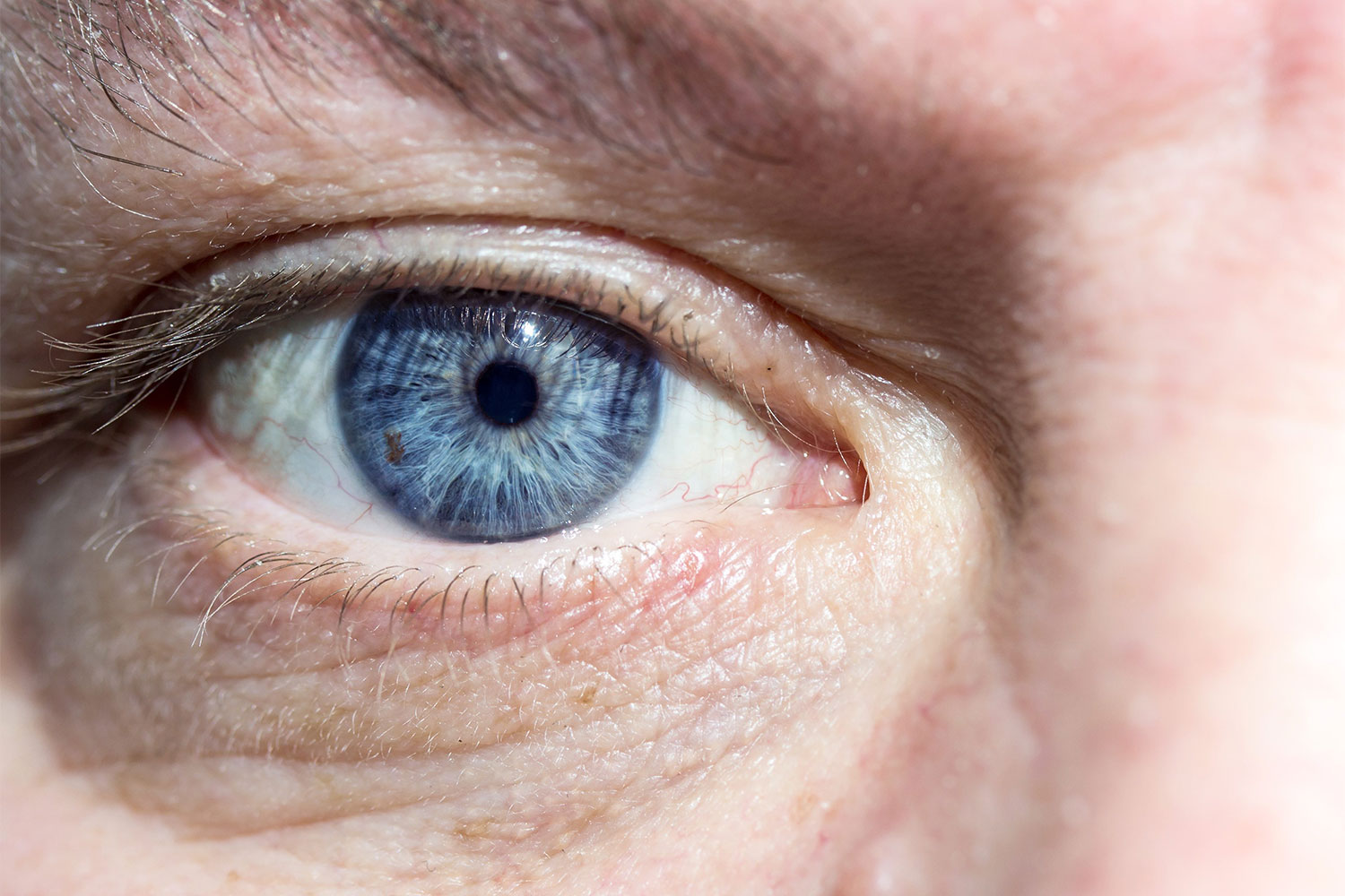 oftalmologie: sindrom de ochi uscat restaurarea vederii Kovalev